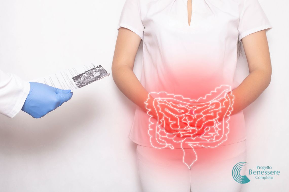 Disbiosi intestinale: la vera causa di moltissimi disturbi, le cause e le soluzioni